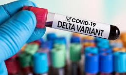 Lee más sobre el artículo Variante Delta infectaría con misma carga viral a vacunados y no vacunados: estudio preliminar