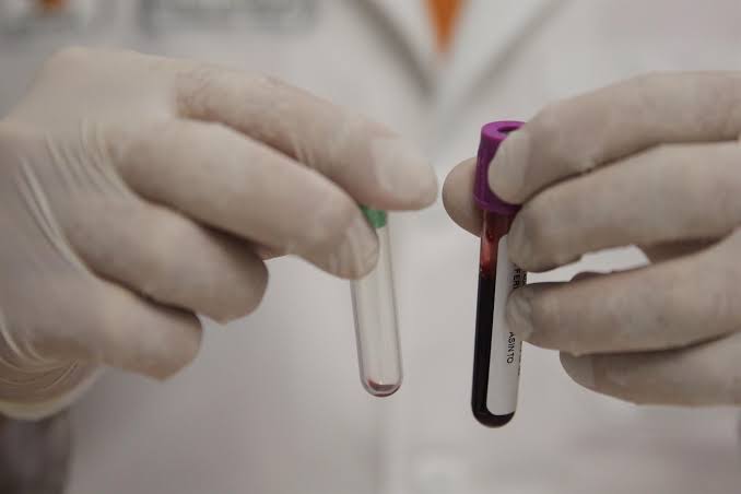 Encuentran por primera vez microplásticos en sangre humana